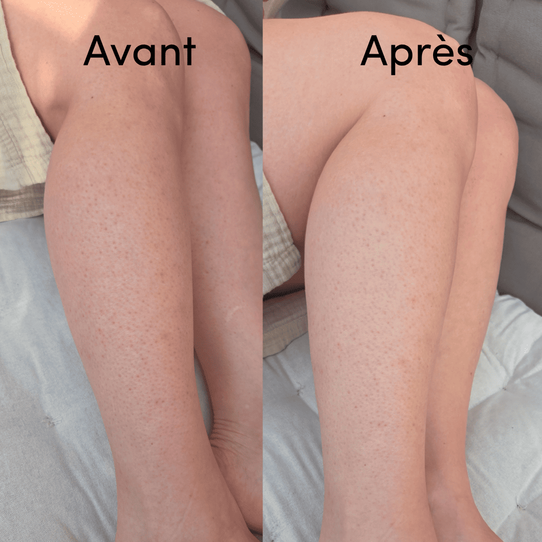Sérum Exfoliant Corps