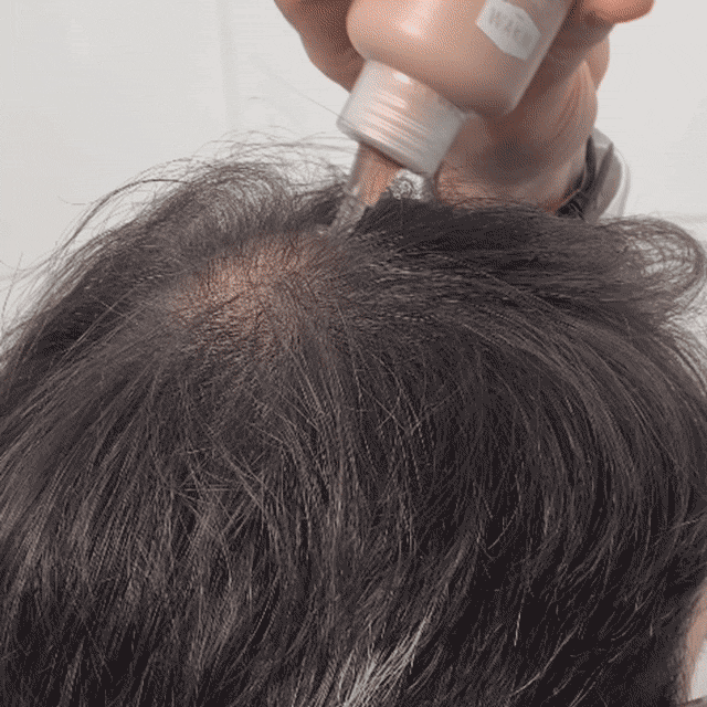 Duo Pousse Barbe & Cheveux