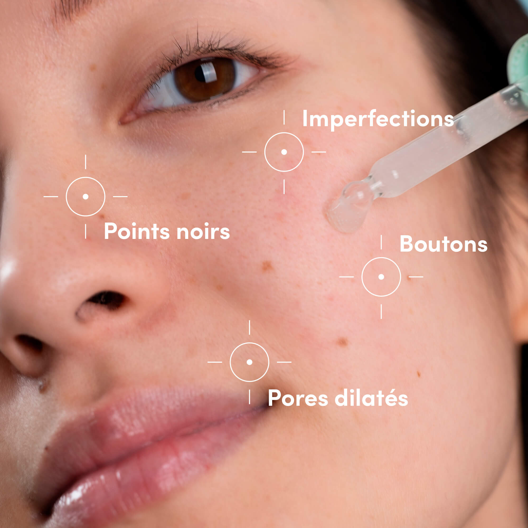 Anti-Imperfection Routine