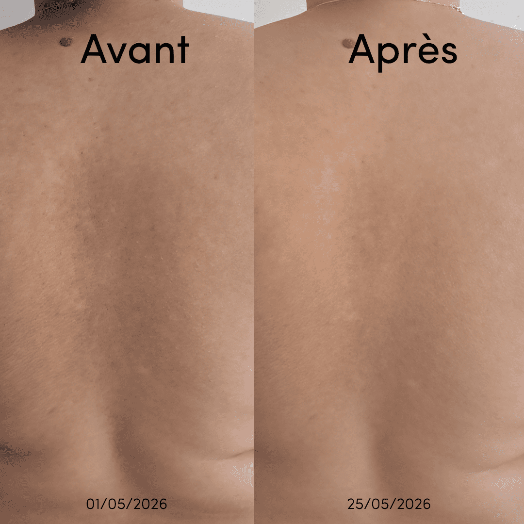 Sérum Exfoliant Corps