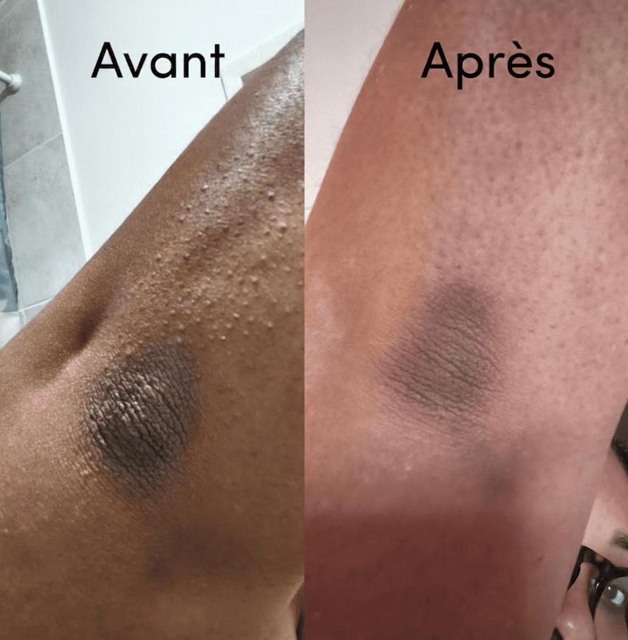 Sérum Exfoliant Corps