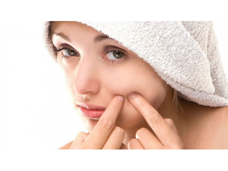 Taking care of acne-prone skin the natural way!